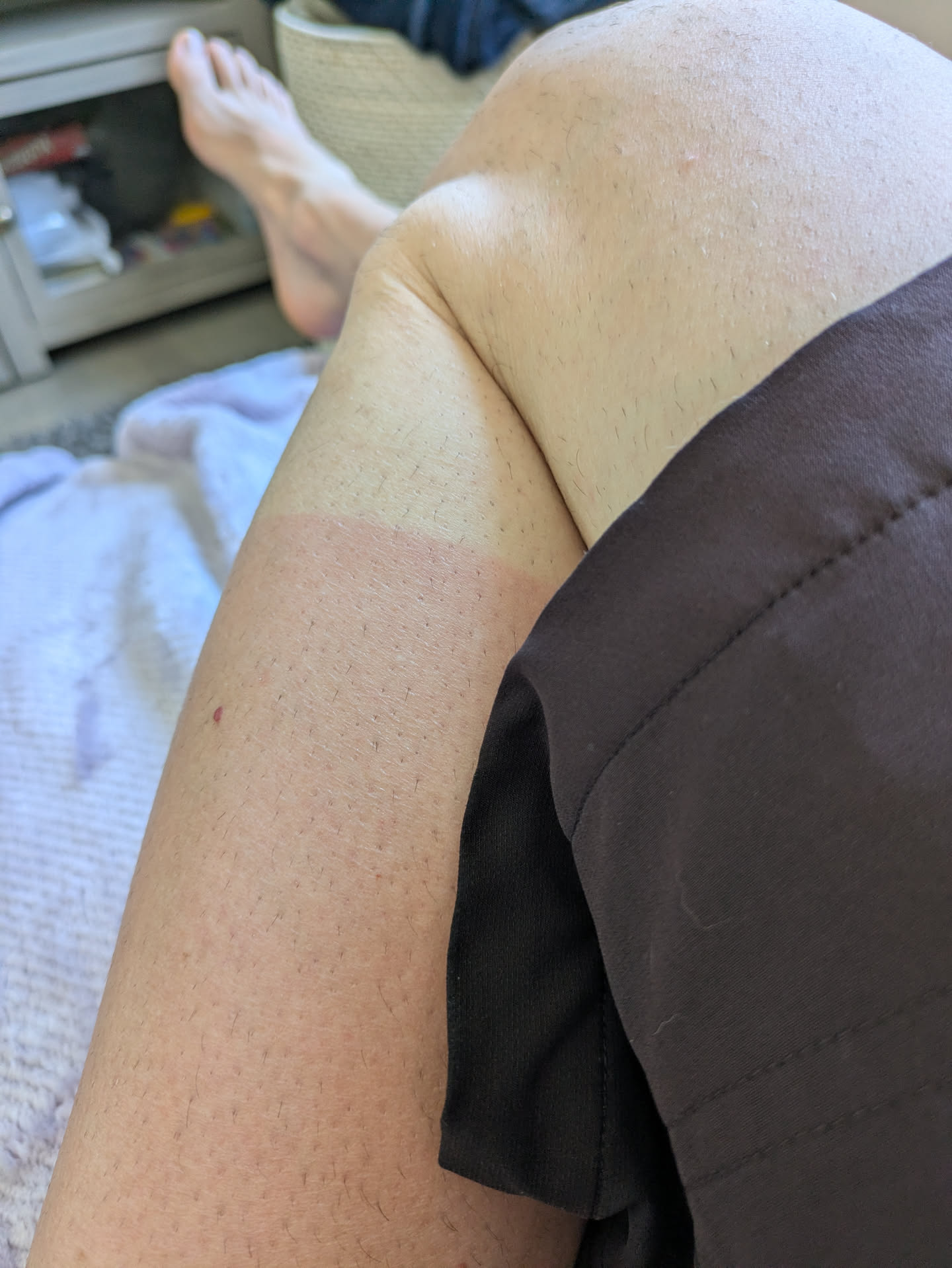 leg